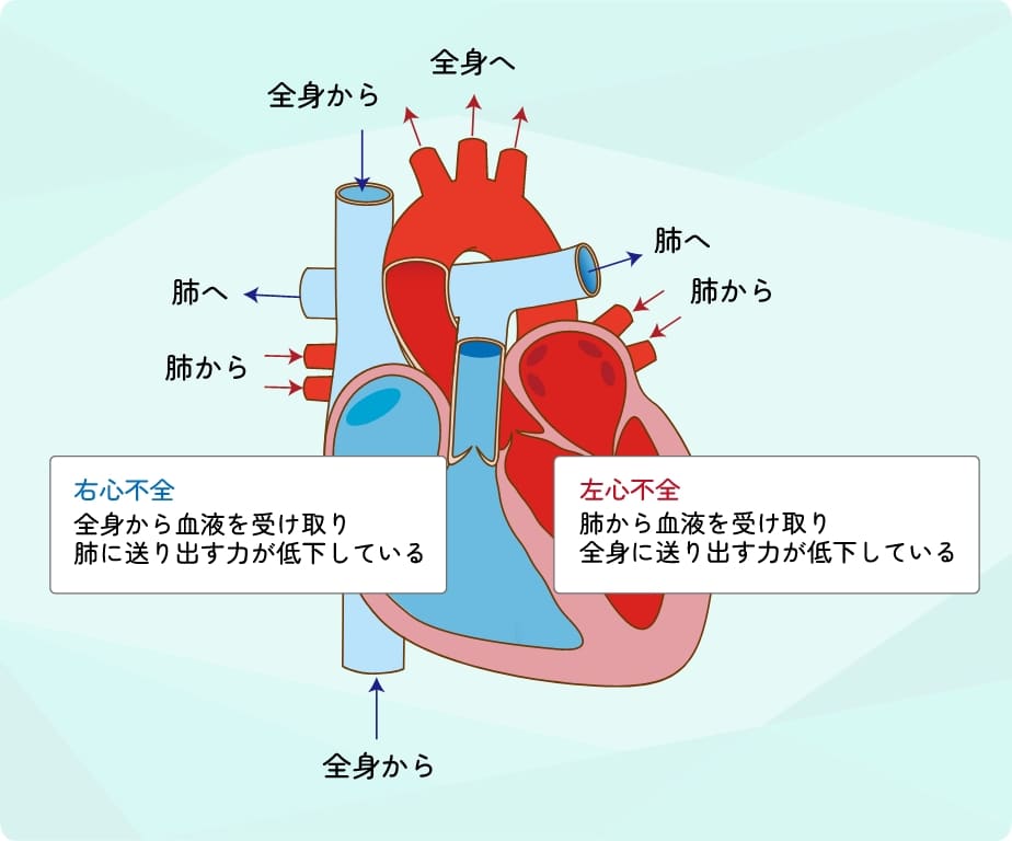 あまり一般的ではない心不全の兆候