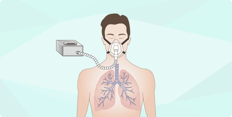 呼吸補助療法
